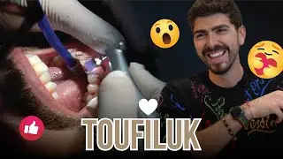 Famous Influencer Toufiluk Gets Teeth Whitening in Turkey.