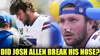 How Did Josh Allen Break His Nose? The Bloody Moment Explained! 