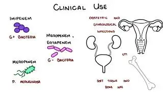 Carbapenem Antibiotics - Meropenem, Imipenem, Ertapenem
