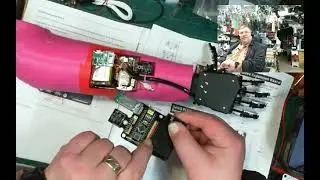 Newest prosthetics arm and fingers controlled  by MPU6050 gyroscope.