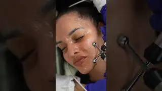 Microcurrent Therapy: The Skincare Revolution of 2025 #skincare #zemits #microcurrent #facial