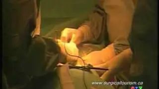 Spine Surgery - Surgical Tourism Canada