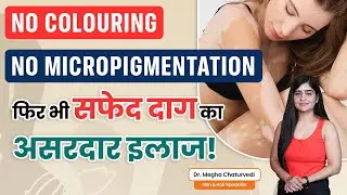 Micropigmentation नहीं करवाया, फिर भी Vitiligo हुआ ठीक &ndash; जानिए कैसे!