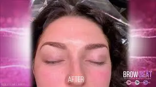Before After Microblading BrowBeat Dallas Microblading  Experts 214 432 3077 10