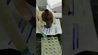 Hemoglobin