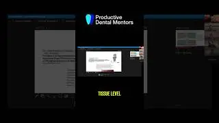 Dental Composite Spider Technique: Gingival Margin Mastery