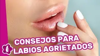 Labios agrietados: consejos para que no se pelen tus labios
