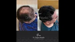 Dr. Pittella &bull; Norwood 6, ONE Sitting: SOLVED