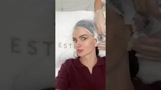 💉Plinest#лицо#beauty#vlog#косметология#косметолог#уходзакожей#красота#кожа#омоложениелица