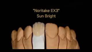 Noritake Ex3 | Veneer | A3 Caramel