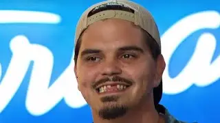American Idol Garbage Man Doug Kiker Doesn&rsquo;t Look Like This Anymore