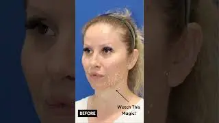 PREVENT AGING and LOOK 10 YEARS YOUNGER with this Facelift!
