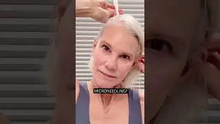 Thinning Hair? Why Microneedling?