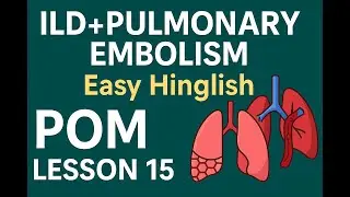Interstitial Lung Disease (ILD) + Pulmonary Embolism (PE) | Davidson Lesson 15 | POM BHMS MBBS FMG