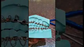 Arch bar wiring fixation on Dental stone cast how it looks before IMF in Oral Maxillofacial surgery
