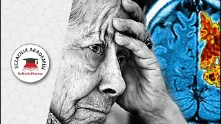 Alzheimer Hastalığında Kullanılan Modifiye Edici Bir İlaç: Adukanumab