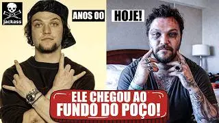 QUEBRADOS E SEQUELADOS: O TRISTE FIM DOS MEMBROS DO JACKASS!