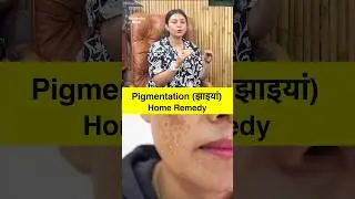 Melasma Pigmentation Home Remedy By Dr. Upasana Vohra | Himanshu Bhatt