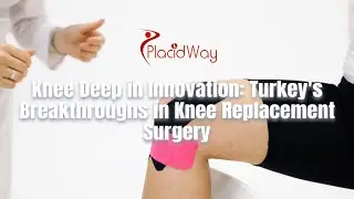 Revolutionizing Mobility: Knee Replacement Surgery in Turkey Innovation
