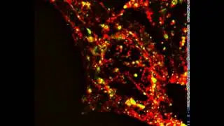 CCL5 intracellular motility on microtubules in tumor cells