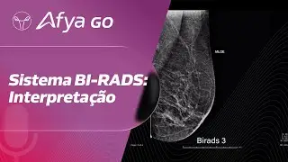 O que devemos saber sobre o BI-RADS e quais s&atilde;o os principais erros de interpreta&ccedil;&atilde;o?