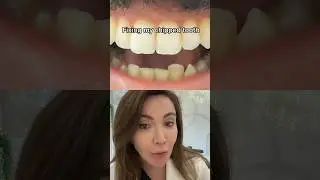 Fixing Chipped Tooth!!