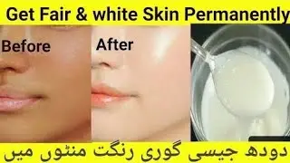 Beauty Tips for Skin Tightening & Anti Aging (Natural Remedy)