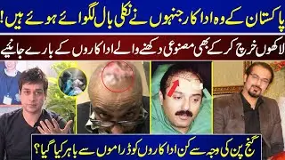Actors Who Have Grown Out Fake Hair | Which Actors Were Kicked Out Of Dramas Because Of Baldness |