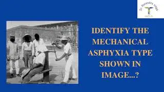 NEET PG QUICK RIVISION IMAGE BASED MCQ:124/ NEETPG2021/ DNBCET/ INICET/ INEXT