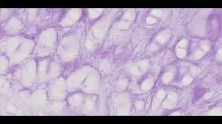 Elastic Cartilage (Resorcin Fuchsin Stain) - PUMS Histology Slides Review Series