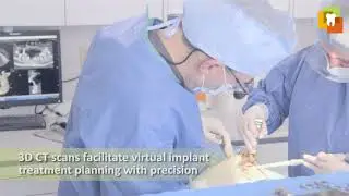 ​​DENTAL IMPLANTS: The Best Dental Clinic in Toronto
