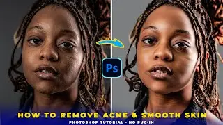 Photoshop | Remove Acne & Smooth Skin FAST | No Plug-ins Needed!