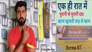 Derma kt neo ~ दाद खाज खुजली जड़ से खत्म करें