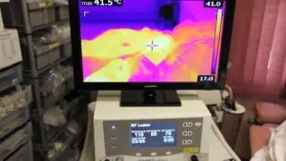 ThermiTight