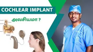 Cochlear Implant அவசியமா ?| Ear drum perforation in tamil | Dr. Manoj ENT Speciality Centre | Trichy