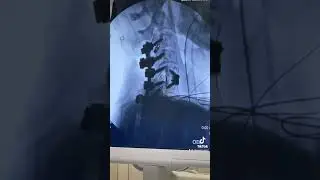 Why Are All the Screws Angled Like That?