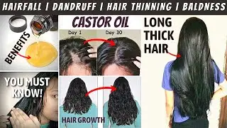 CASTOR OIL Benefits For HAIR in Hindi | Best Castor Oil for HAIR GROWTH | Stop HAIRFALL & DANDRUFF