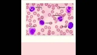 peripheral blood smear identify abnormalities in cell size #whitebloodcells #redbloodcells