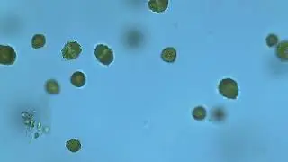 Peridinium bloom, Dinoflagellates