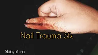 Nail Trauma Sfx Tutorial | Deception | Fake Makeup | #sfxtutorial #sfxartist #fakemakeup #youtuber