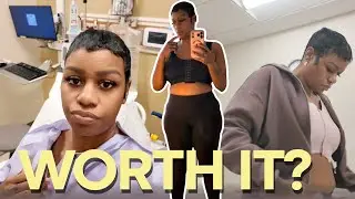 I Got a Breast Reduction | Surgery, Recovery, Pain & Results