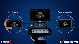 Ultrasonido Samsung V8 para la salud de la mujer