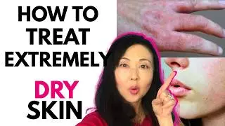 How to Treat EXTREMELY DRY Skin #barrierrepair #goseechristy 3 Tips on Barrier Repair
