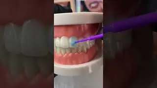 GlitzGrinz Tooth Gems DIY Kit