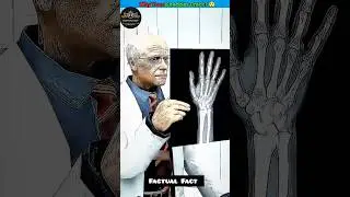 The Science Behind Knuckle Cracking 😳#knucklecrack#bodyfacts#sciencefacts#healthfacts#humanbody