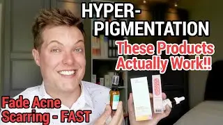 TREATING HYPERPIGMENTATION - How I Faded My Acne Scars