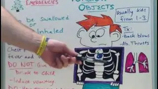 Foreign Objects - Emergency video for medical students - USMLE Step 1