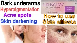alpha glow cream| Glycolic acid cream | For skin darkness,acne | How to use | side effects