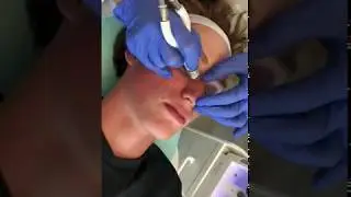 Up Close Dermalinfusion Facial Treatment