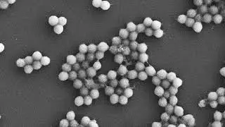 SEM of mimivirus